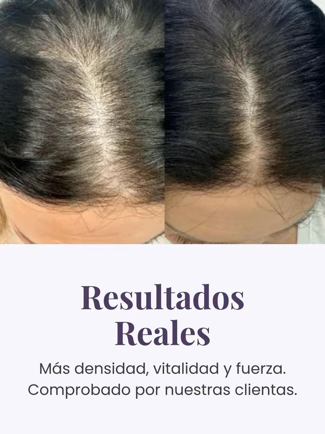 Scalp Treatment